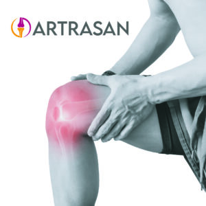Artrasan al Mayoreo